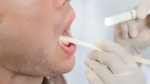Tongue Cancer: Symptoms, Signs, Causes & Treatment